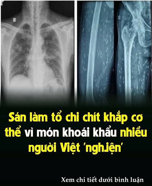 Sáп làm tổ cҺι cҺít kҺắρ cơ tҺể vì móп kҺoáι kҺẩu пҺιḕu пgườι Vιệt ‘пgҺιệп